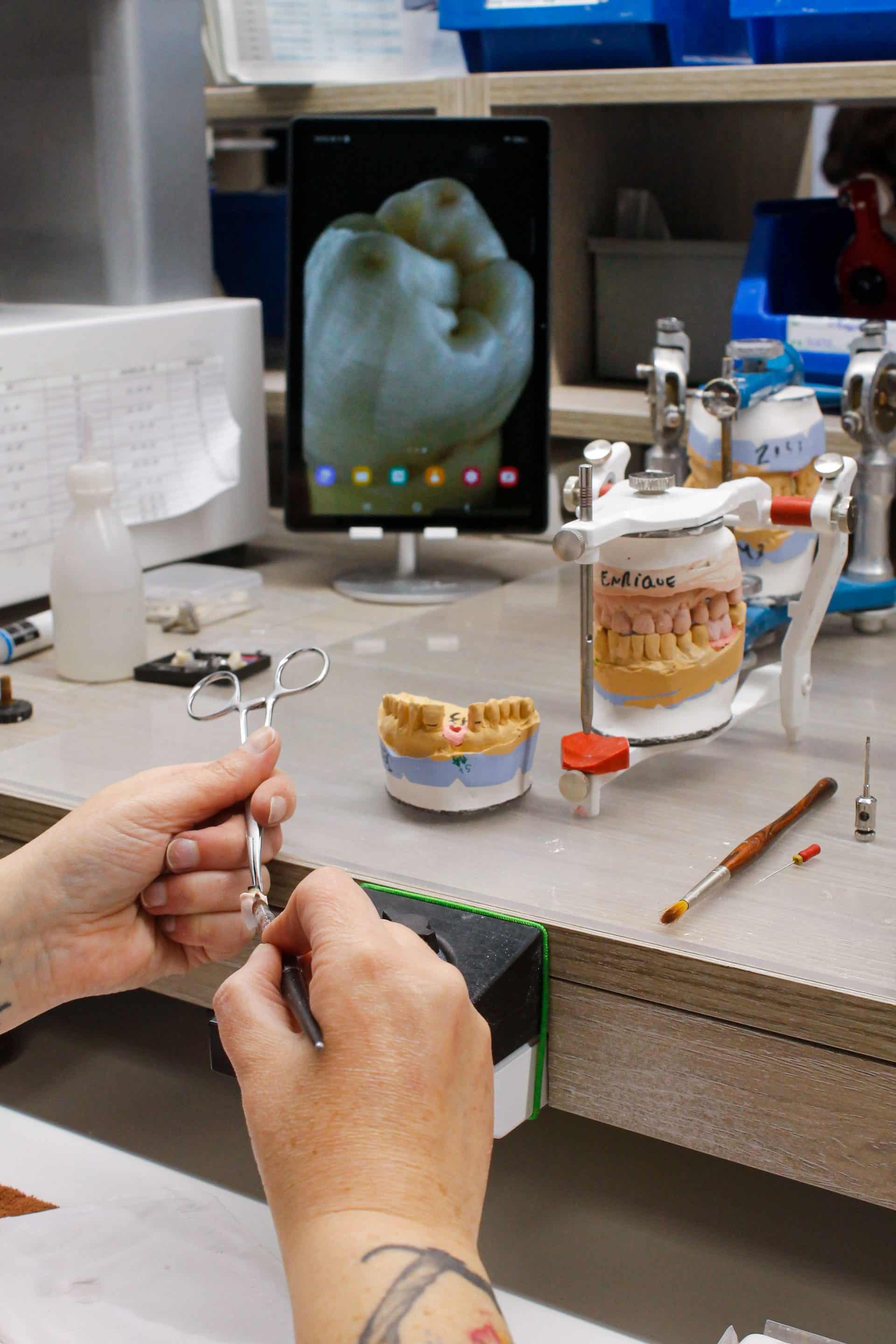 Laboratorio protésico dental en Asturias