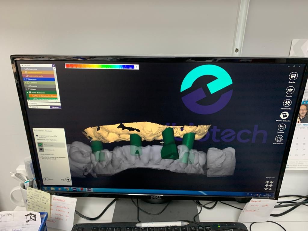 Laboratorio Nalón Dental, Oviedo